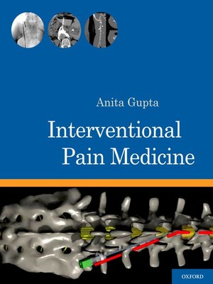 cover image of Interventional Pain Medicine